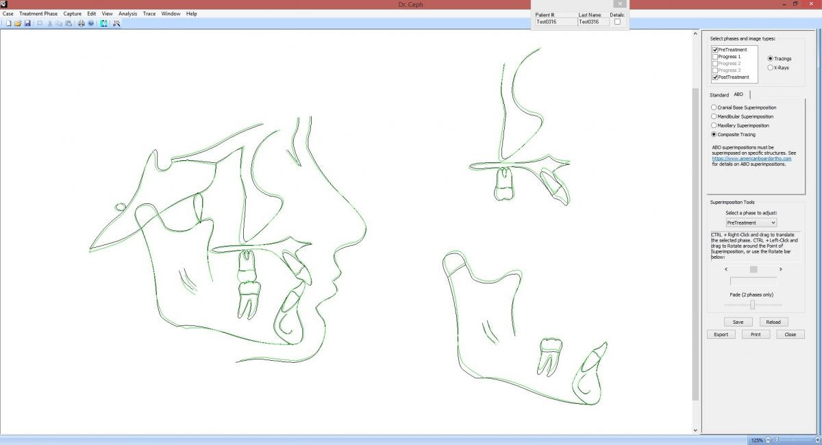 Dr. Ceph & Dr. View Screenshot 2