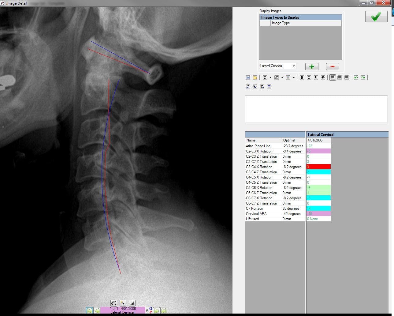 Spinalogic Screenshot 4