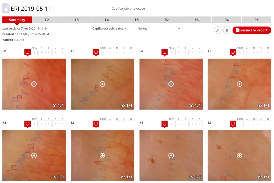 Capillary.io Screenshot 1