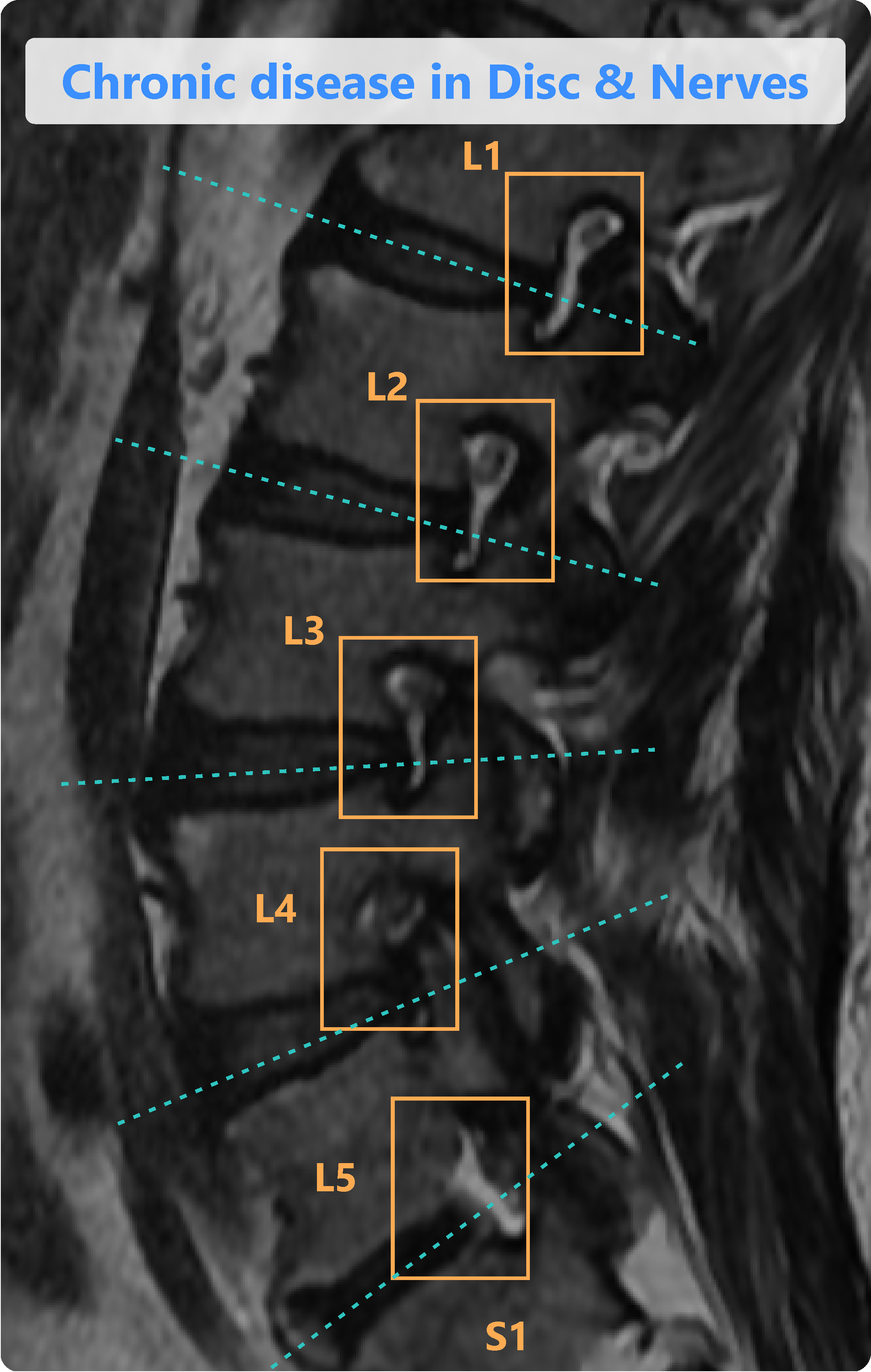 Spindle Screenshot 1