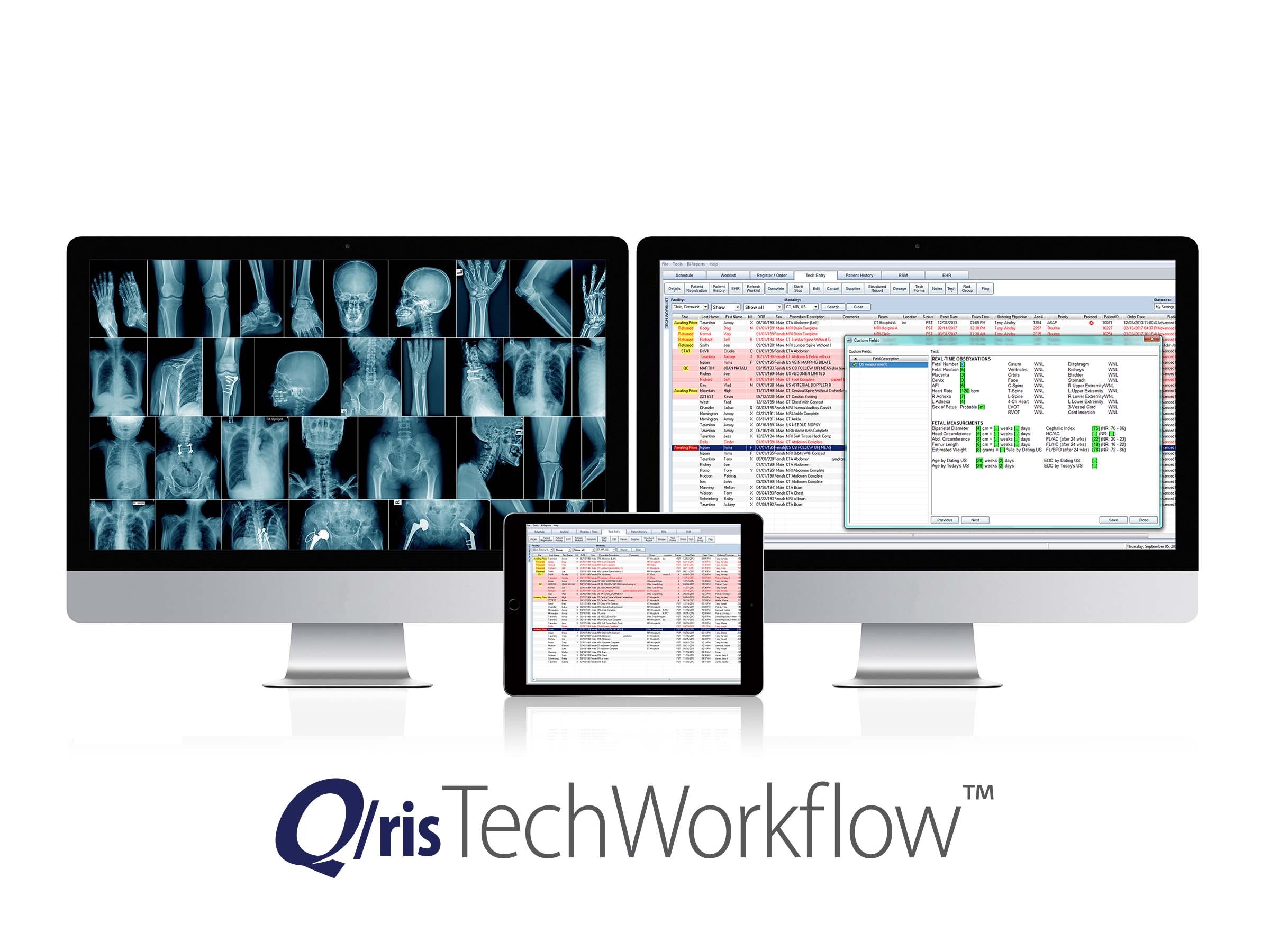 Q/ris 3000 Workflow Screenshot 3